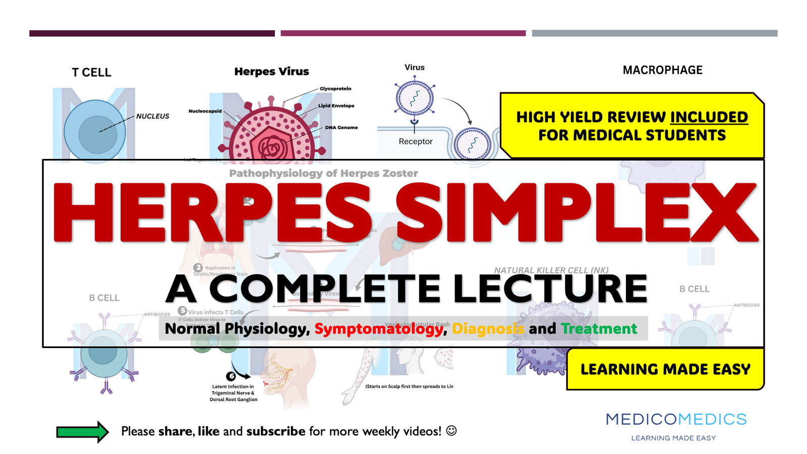 Herpes Simplex Virus (HSV)